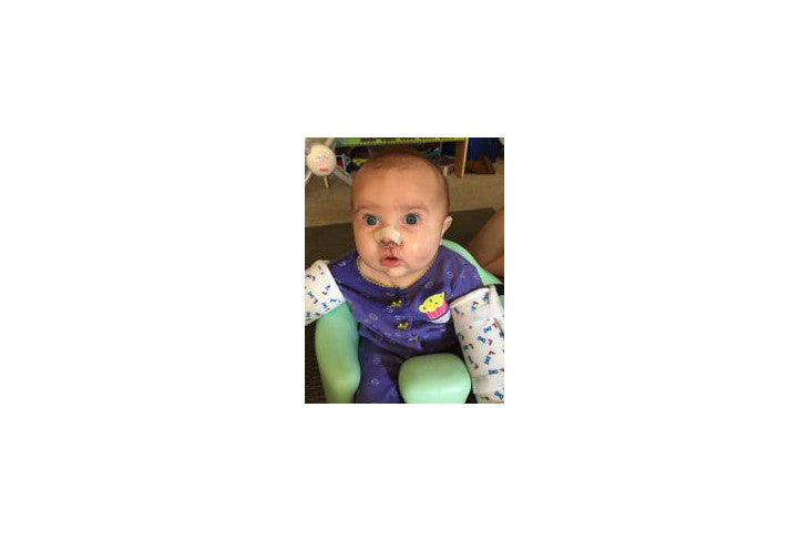 Zaylee's Post OP Progress